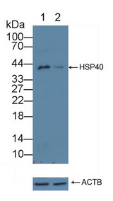DNAJB1 / Hsp40 Antibody - Knockout Varification: Lane 1: Wild-type Jurkat cell lysate; Lane 2: HSP40 knockout Jurkat cell lysate; Predicted MW: 38kd Observed MW: 42kd Primary Ab: 3µg/ml Rabbit Anti-Mouse HSP40 Antibody Second Ab: 0.2µg/mL HRP-Linked Caprine Anti-Rabbit IgG Polyclonal Antibody