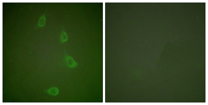 DNAJB1 / Hsp40 Antibody - Immunofluorescence analysis of NIH/3T3 cells, using HSP40 Antibody. The picture on the right is blocked with the synthesized peptide.