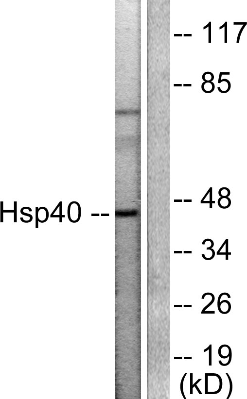 DNAJB1 / Hsp40 Antibody - Western blot analysis of lysates from COLO205 cells, using HSP40 Antibody. The lane on the right is blocked with the synthesized peptide.