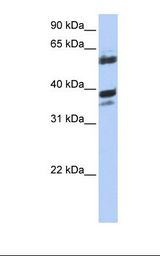DNAJB1 / Hsp40 Antibody - 721_B cell lysate. Antibody concentration: 1.0 ug/ml. Gel concentration: 12%.  This image was taken for the unconjugated form of this product. Other forms have not been tested.