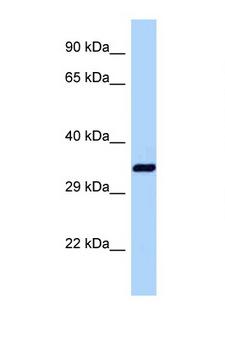 DNAJB1 / Hsp40 Antibody - DNAJB1 / Hsp40 antibody Western blot of Mouse Liver lysate. Antibody concentration 1 ug/ml.  This image was taken for the unconjugated form of this product. Other forms have not been tested.