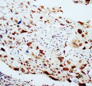 DNAJB1 / Hsp40 Antibody -  This image was taken for the unconjugated form of this product. Other forms have not been tested.