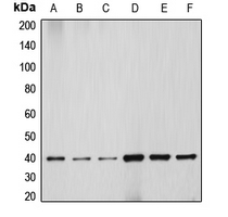 DNAJB1 / Hsp40 Antibody - Western blot analysis of HSP40 expression in HEK293T (A); HeLa (B); NIH3T3 (C); PC12 (D); Jurkat (E); HepG2 (F) whole cell lysates.
