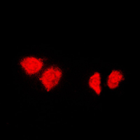 DNAJB1 / Hsp40 Antibody - Immunofluorescent analysis of HSP40 staining in HeLa cells. Formalin-fixed cells were permeabilized with 0.1% Triton X-100 in TBS for 5-10 minutes and blocked with 3% BSA-PBS for 30 minutes at room temperature. Cells were probed with the primary antibody in 3% BSA-PBS and incubated overnight at 4 C in a humidified chamber. Cells were washed with PBST and incubated with a DyLight 594-conjugated secondary antibody (red) in PBS at room temperature in the dark. DAPI was used to stain the cell nuclei (blue).