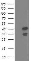 DNAJB1 / Hsp40 Antibody - HEK293T cells were transfected with the pCMV6-ENTRY control (Left lane) or pCMV6-ENTRY DNAJB1 (Right lane) cDNA for 48 hrs and lysed. Equivalent amounts of cell lysates (5 ug per lane) were separated by SDS-PAGE and immunoblotted with anti-DNAJB1.