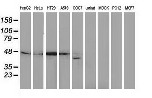 DNAJB1 / Hsp40 Antibody - Western blot of extracts (35ug) from 9 different cell lines by using anti-DNAJB1 monoclonal antibody.