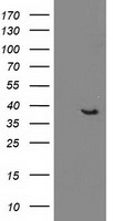 DNAJB1 / Hsp40 Antibody - HEK293T cells were transfected with the pCMV6-ENTRY control (Left lane) or pCMV6-ENTRY DNAJB1 (Right lane) cDNA for 48 hrs and lysed. Equivalent amounts of cell lysates (5 ug per lane) were separated by SDS-PAGE and immunoblotted with anti-DNAJB1.