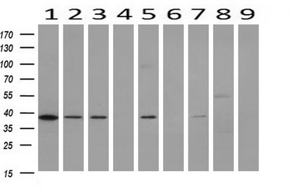 DNAJB1 / Hsp40 Antibody - Western blot of extracts (10ug) from 9 Human tissue by using anti-DNAJB1 monoclonal antibody at 1:200 (1: Testis; 2: Omentum; 3: Uterus; 4: Breast; 5: Brain; 6: Liver; 7: Ovary; 8: Thyroid gland; 9: colon).