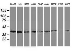 DNAJB1 / Hsp40 Antibody - Western blot of extracts (35ug) from 9 different cell lines by using anti-DNAJB1 monoclonal antibody.