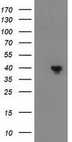 DNAJB1 / Hsp40 Antibody - HEK293T cells were transfected with the pCMV6-ENTRY control (Left lane) or pCMV6-ENTRY DNAJB1 (Right lane) cDNA for 48 hrs and lysed. Equivalent amounts of cell lysates (5 ug per lane) were separated by SDS-PAGE and immunoblotted with anti-DNAJB1.