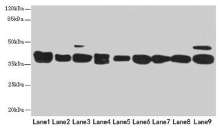 DNAJB1 / Hsp40 Antibody - Western blot All lanes: DNAJB1 antibody at 1.6 µg/ml Lane 1: HepG2 whole cell lysate Lane 2: Mouse heart tissue Lane 3: Mouse liver tissue Lane 4: Mouse lung tissue Lane 5: Mouse kidney tissue Lane 6: Mouse brain tissue Lane 7: Mouse thymus tissue Secondary Goat polyclonal to rabbit IgG at 1/10000 dilution Predicted band size: 39, 28 kDa Observed band size: 38 kDa