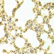 DNAJB1 / Hsp40 Antibody - Immunohistochemistry of paraffin-embedded mouse lung tissue.