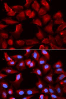 DNAJB1 / Hsp40 Antibody - Immunofluorescence analysis of U20S cells.
