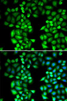 DNAJB1 / Hsp40 Antibody - Immunofluorescence analysis of HeLa cells.
