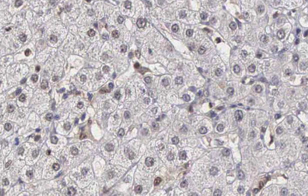 DNAJB1 / Hsp40 Antibody - 1:100 staining human liver tissue by IHC-P. The tissue was formaldehyde fixed and a heat mediated antigen retrieval step in citrate buffer was performed. The tissue was then blocked and incubated with the antibody for 1.5 hours at 22°C. An HRP conjugated goat anti-rabbit antibody was used as the secondary.