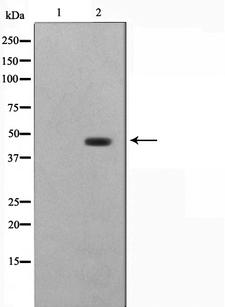 DNAJB1 / Hsp40 Antibody - Western blot analysis on COLO205 cell lysates using HSP40 antibody. The lane on the left is treated with the antigen-specific peptide.
