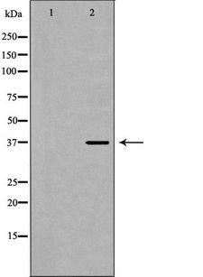 DNAJB1 / Hsp40 Antibody - Western blot analysis of HeLa whole cells lysates using DNAJB1 antibody. The lane on the left is treated with the antigen-specific peptide.