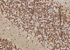 DNAJB1 / Hsp40 Antibody - 1:100 staining rat brain tissue by IHC-P. The sample was formaldehyde fixed and a heat mediated antigen retrieval step in citrate buffer was performed. The sample was then blocked and incubated with the antibody for 1.5 hours at 22°C. An HRP conjugated goat anti-rabbit antibody was used as the secondary.