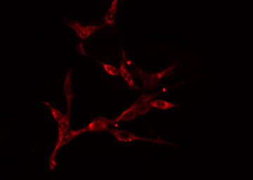 DNAJB1 / Hsp40 Antibody - Staining COLO205 cells by IF/ICC. The samples were fixed with PFA and permeabilized in 0.1% Triton X-100, then blocked in 10% serum for 45 min at 25°C. The primary antibody was diluted at 1:200 and incubated with the sample for 1 hour at 37°C. An Alexa Fluor 594 conjugated goat anti-rabbit IgG (H+L) antibody, diluted at 1/600, was used as secondary antibody.