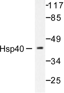 DNAJB1 / Hsp40 Antibody - Western blot of HSP40/HDJ-1 (P303) pAb in extracts from COLO205 cells.