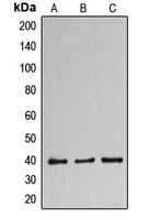 DNAJB11 Antibody - Western blot analysis of DNAJB11 expression in HUVEC (A); NCIH460 (B); MCF7 (C) whole cell lysates.