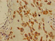 DNAJB11 Antibody - Immunohistochemistry image of paraffin-embedded human placenta tissue at a dilution of 1:100