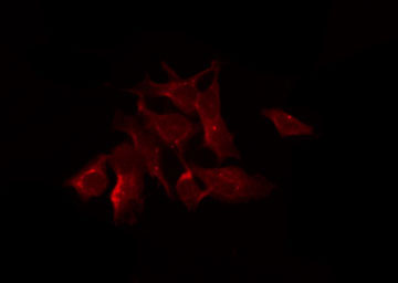DNAJB11 Antibody - Staining HeLa cells by IF/ICC. The samples were fixed with PFA and permeabilized in 0.1% Triton X-100, then blocked in 10% serum for 45 min at 25°C. The primary antibody was diluted at 1:200 and incubated with the sample for 1 hour at 37°C. An Alexa Fluor 594 conjugated goat anti-rabbit IgG (H+L) Ab, diluted at 1/600, was used as the secondary antibody.