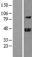 DNAJB11 Protein - Western validation with an anti-DDK antibody * L: Control HEK293 lysate R: Over-expression lysate