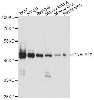 DNAJB12 Antibody - Western blot analysis of extracts of various cell lines, using DNAJB12 antibody at 1:1000 dilution. The secondary antibody used was an HRP Goat Anti-Rabbit IgG (H+L) at 1:10000 dilution. Lysates were loaded 25ug per lane and 3% nonfat dry milk in TBST was used for blocking. An ECL Kit was used for detection and the exposure time was 10s.