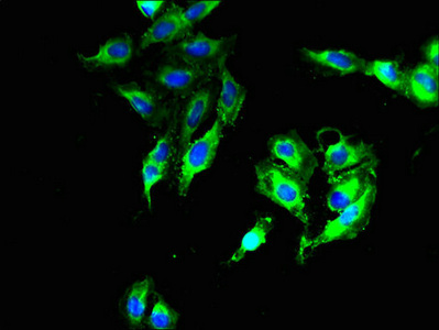 DNAJB14 Antibody - Immunofluorescent analysis of Hela cells using DNAJB14 Antibody at dilution of 1:100 and Alexa Fluor 488-congugated AffiniPure Goat Anti-Rabbit IgG(H+L)