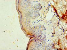 DNAJB2 Antibody - Immunohistochemistry of paraffin-embedded human skin tissue using antibody at 1:100 dilution.  This image was taken for the unconjugated form of this product. Other forms have not been tested.