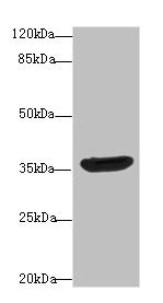 DNAJB2 Antibody - Western blot All lanes: DnaJ homolog subfamily B member 2 antibody at 10µg/ml + A431 whole cell lysate Secondary Goat polyclonal to rabbit IgG at 1/10000 dilution Predicted band size: 36, 31 kDa Observed band size: 36 kDa