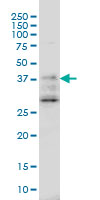 DNAJB2 Antibody - DNAJB2 monoclonal antibody (M03), clone 2C9 Western blot of DNAJB2 expression in A-431.