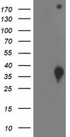 DNAJB2 Antibody - HEK293T cells were transfected with the pCMV6-ENTRY control (Left lane) or pCMV6-ENTRY DNAJB2 (Right lane) cDNA for 48 hrs and lysed. Equivalent amounts of cell lysates (5 ug per lane) were separated by SDS-PAGE and immunoblotted with anti-DNAJB2.