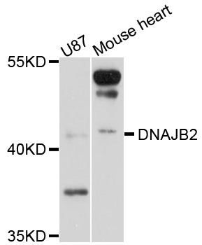 DNAJB2 Antibody - Western blot analysis of extracts of various cell lines, using DNAJB2 antibody at 1:1000 dilution. The secondary antibody used was an HRP Goat Anti-Rabbit IgG (H+L) at 1:10000 dilution. Lysates were loaded 25ug per lane and 3% nonfat dry milk in TBST was used for blocking. An ECL Kit was used for detection and the exposure time was 30s.
