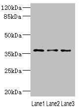 DNAJB2 Antibody - Western blot All Lanes: DNAJB2 antibody at 1.18ug/ml Lane 1: 293T whole cell lysate Lane 2: PC-3 whole cell lysate Lane 3: A431 whole cell lysate Secondary Goat polyclonal to rabbit IgG at 1/10000 dilution Predicted band size: 36,31 kDa Observed band size: 36 kDa