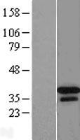 DNAJB2 Protein - Western validation with an anti-DDK antibody * L: Control HEK293 lysate R: Over-expression lysate