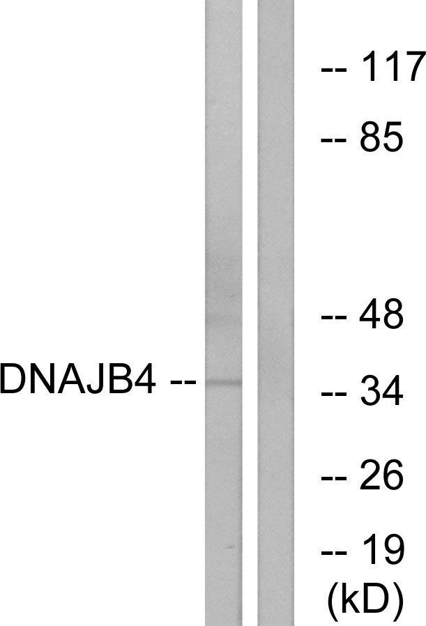 DNAJB4 Antibody - Western blot analysis of lysates from HepG2 cells, using DNAJB4 Antibody. The lane on the right is blocked with the synthesized peptide.