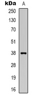 DNAJB4 Antibody - Western blot analysis of DNAJB4 expression in Jurkat (A) whole cell lysates.