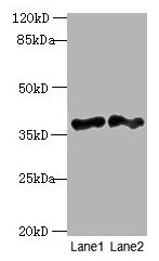 DNAJB4 Antibody - Western blot All lanes: DNAJB4 antibody at 2µg/ml Lane 1: Hela whole cell lysate Lane 2: Mouse heart tissue Secondary Goat polyclonal to rabbit IgG at 1/10000 dilution Predicted band size: 38 kDa Observed band size: 38 kDa