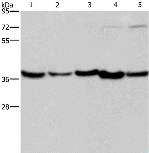 DNAJB4 Antibody - Western blot analysis of Human fetal liver, mouse skeletal muscle and heart tissue, HeLa and Jurkat cell, using DNAJB4 Polyclonal Antibody at dilution of 1:200.