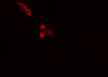 DNAJB4 Antibody - Staining HepG2 cells by IF/ICC. The samples were fixed with PFA and permeabilized in 0.1% Triton X-100, then blocked in 10% serum for 45 min at 25°C. The primary antibody was diluted at 1:200 and incubated with the sample for 1 hour at 37°C. An Alexa Fluor 594 conjugated goat anti-rabbit IgG (H+L) antibody, diluted at 1/600, was used as secondary antibody.