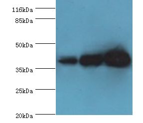 DNAJB5 Antibody - Western blot. All lanes: DNAJB5 antibody at 2 ug/ml. Lane 1: HepG2 whole cell lysate Lane 2: HeLa whole cell lysate Lane 3: Jurkat whole cell lysate. Secondary antibody: goat polyclonal to rabbit at 1:10000 dilution. Predicted band size: 39 kDa. Observed band size: 39 kDa.  This image was taken for the unconjugated form of this product. Other forms have not been tested.