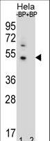 DNAJB6 Antibody - Western blot of DNAJB6 Antibody antibody pre-incubated without(lane 1) and with(lane 2) blocking peptide in HeLa cell line lysate. DNAJB6 Antibody (arrow) was detected using the purified antibody.