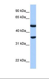 DNAJB6 Antibody - Fetal muscle lysate. Antibody concentration: 1.0 ug/ml. Gel concentration: 12%.  This image was taken for the unconjugated form of this product. Other forms have not been tested.