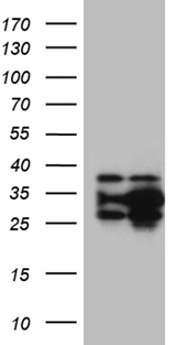 DNAJB6 Antibody - HEK293T cells were transfected with the pCMV6-ENTRY control. (Left lane) or pCMV6-ENTRY DNAJB6. (Right lane) cDNA for 48 hrs and lysed. Equivalent amounts of cell lysates. (5 ug per lane) were separated by SDS-PAGE and immunoblotted with anti-DNAJB6. (1:2000)