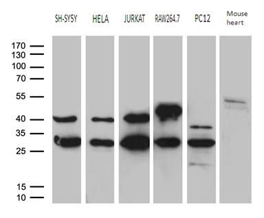 DNAJB6 Antibody - Western blot analysis of extracts. (35ug) from 5 different cell lines and mouse heart tissue lysate by using anti-DNAJB6 monoclonal antibody. (1:500)