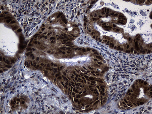 DNAJB6 Antibody - Immunohistochemical staining of paraffin-embedded Carcinoma of Human spleen tissue using anti-DNAJB6 mouse monoclonal antibody. (Heat-induced epitope retrieval by 1mM EDTA in 10mM Tris buffer. (pH8.5) at 120 oC for 3 min. (1:150)
