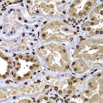DNAJB6 Antibody - Immunohistochemistry of paraffin-embedded human kidney tissue.