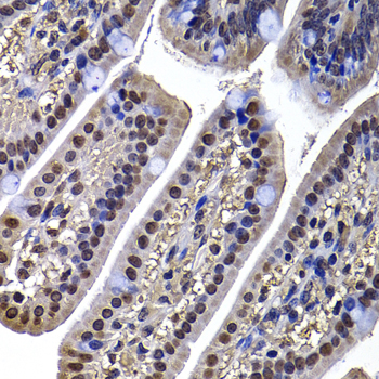 DNAJB6 Antibody - Immunohistochemistry of paraffin-embedded mouse ileum tissue.
